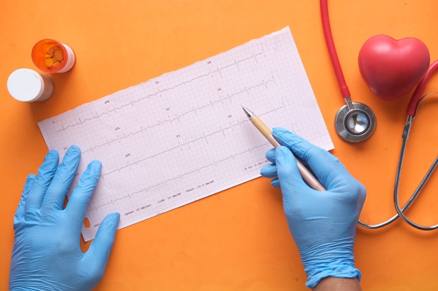 Electrocardiograma y material clínico de cardiología
