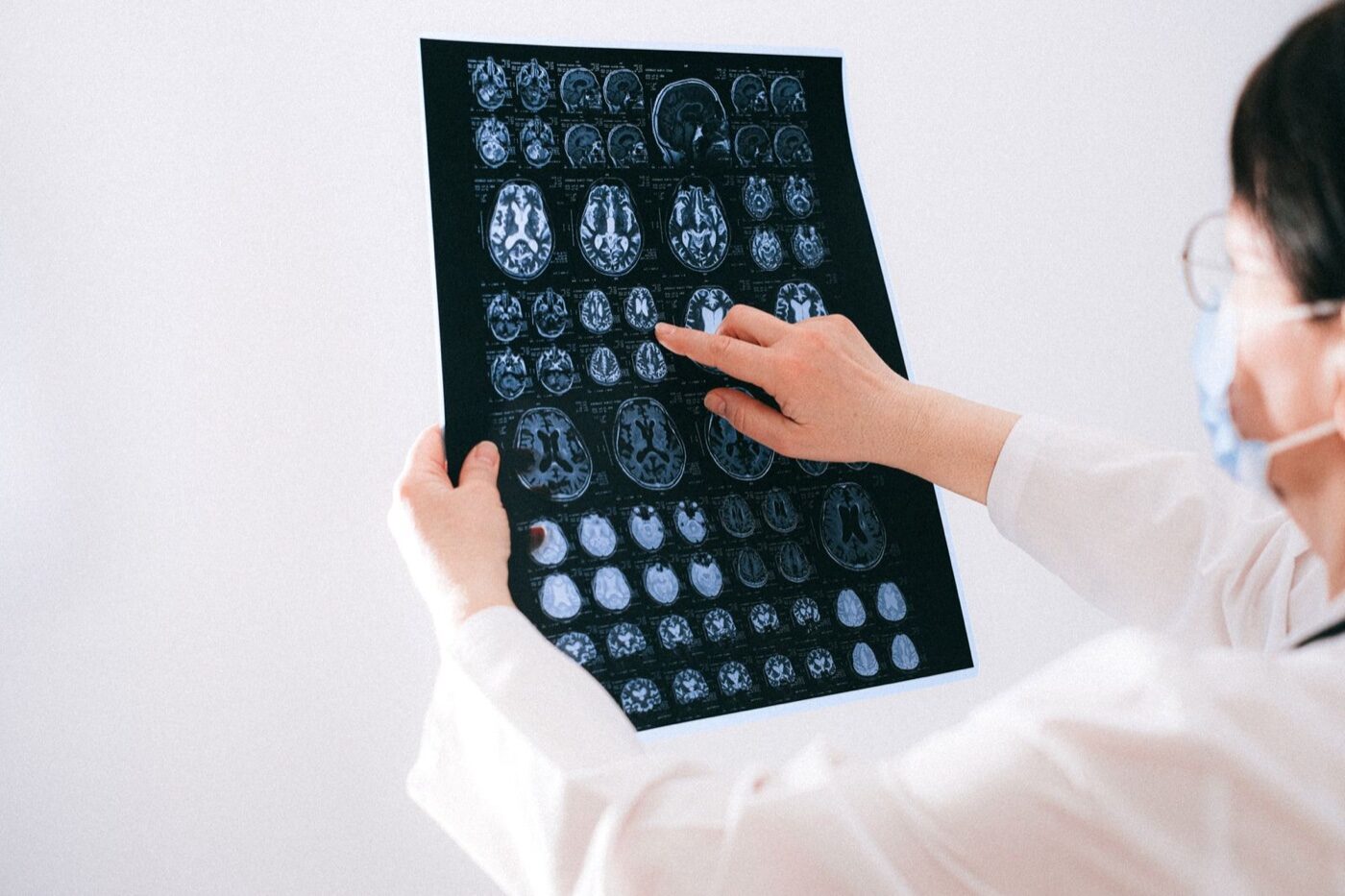 Profesional médico revisando imágenes de resonancia cerebral