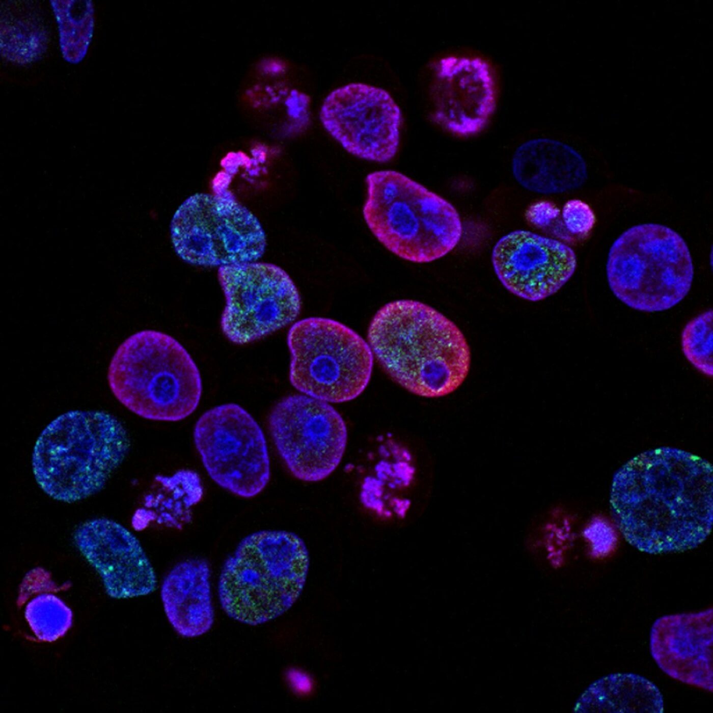 Imagen microscópica de células en investigación oncológica